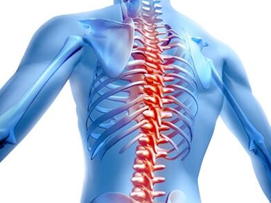 лезија на 'рбетот со остеохондроза