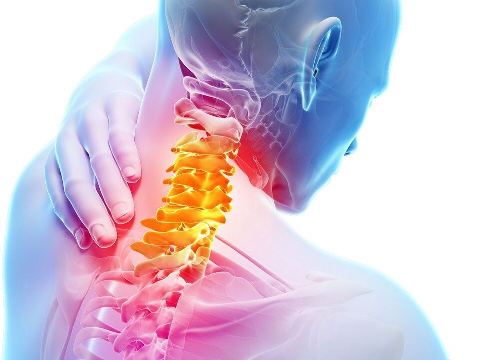 симптоми на 'рбетна остеохондроза