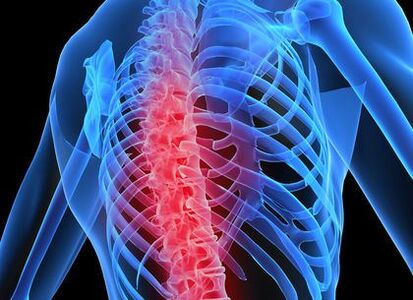 остеохондроза на торакалниот 'рбет