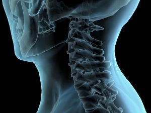 методи за дијагностицирање на остеохондроза на вратот